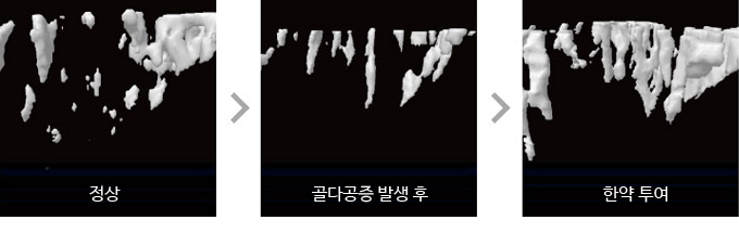 정상 – Нормальное состояние 골다공증발생후 – После возникновение остеопороза    한약투여 – После введения лекарственных препаратов