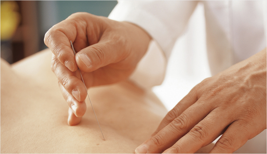 요통환자 침치료 | 자생의료재단