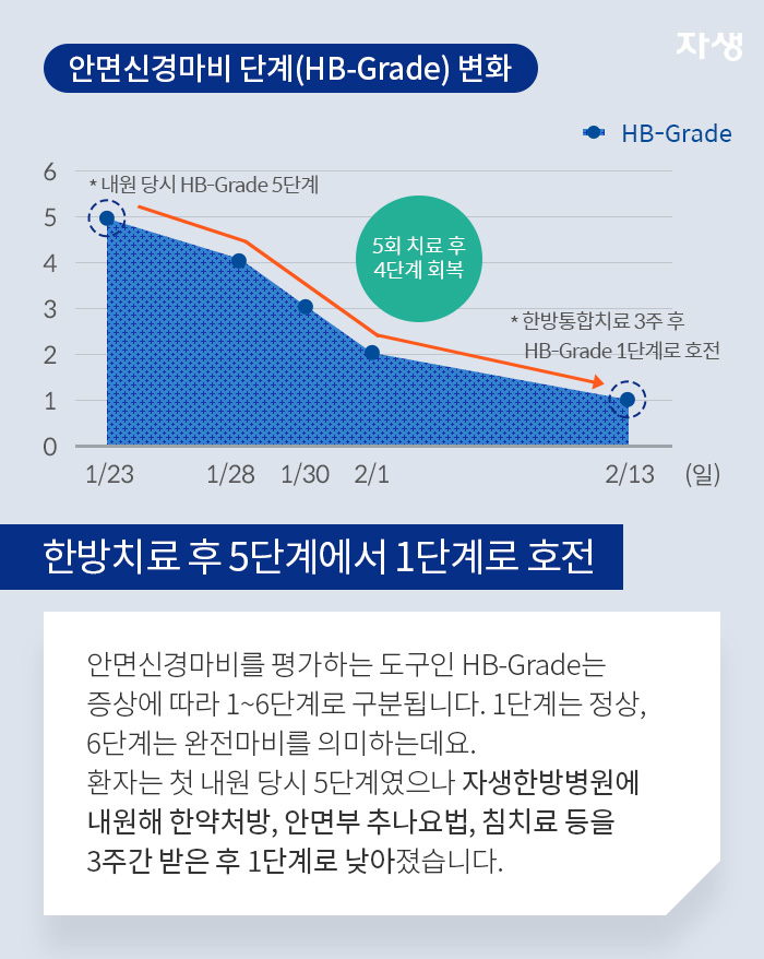 안면신경마비 단계(HB-Grade)변화 그래프 - 한방치료 후 5단계에서 1단계로 호전 - 
안면신경마비를 평가하는 도구인 HB-Grade는 증상에 따라 1~6단계로 구분됩니다. 1단계는 정상, 6단계는 완전마비를 의미하는데요. 환자는 첫 내원 당시 5단계였으나 자생한방병원에 내원해 한약처방, 안면부 추나요법, 침치료 등을 3주간 받은 후 1단계로 낮아졌습니다.