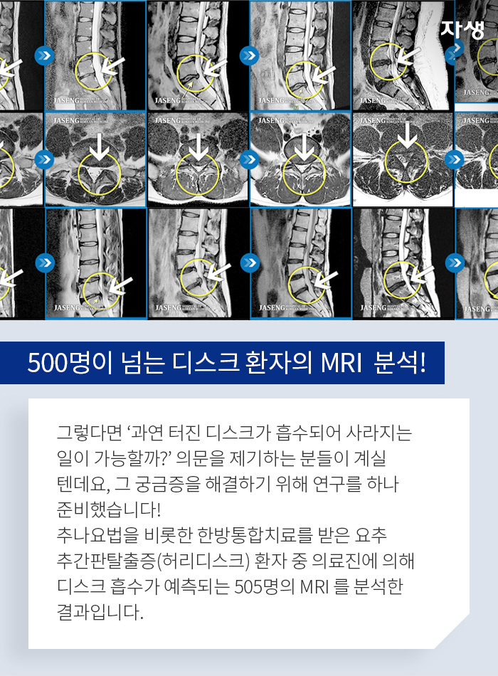 500명이 넘는 디스크 환자의 MRI  분석! - 그렇다면 ‘과연 터진 디스크가 흡수되어 사라지는 일이 가능할까?’ 의문을 제기하는 분들이 계실 텐데요, 그 궁금증을 해결하기 위해 연구를 하나 준비했습니다! 추나요법을 비롯한 한방통합치료를 받은 요추 추간판탈출증(허리디스크) 환자 중 의료진에 의해 디스크 흡수가 예측되는 505명의 MRI 를 분석한 결과입니다.